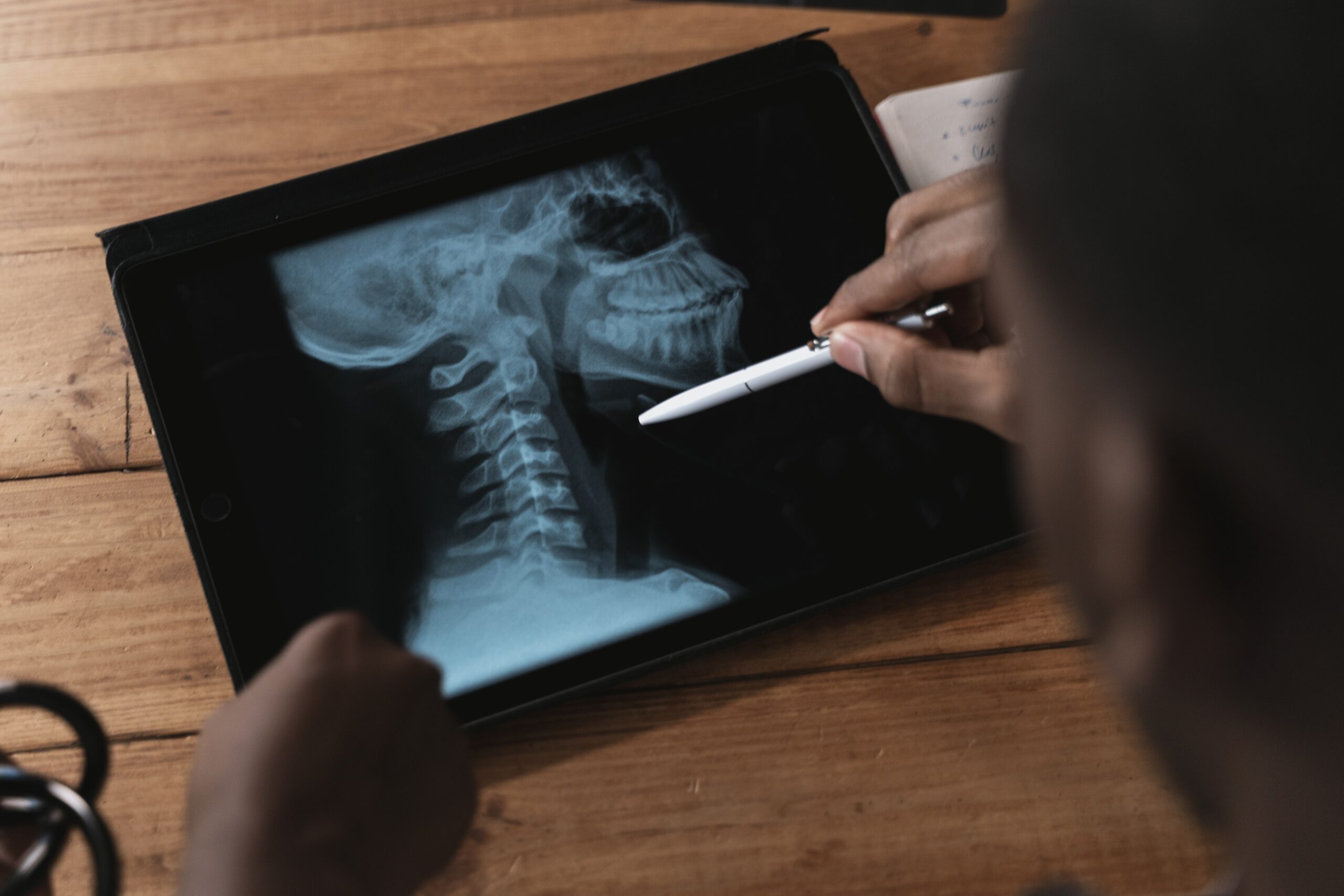 Person uses tablet to view a dental X-ray, pen-like device nearby on a wooden table.