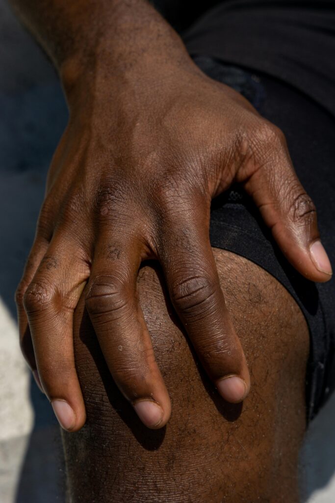 Close-up of a dark-skinned hand resting on the thigh, fingers relaxed.